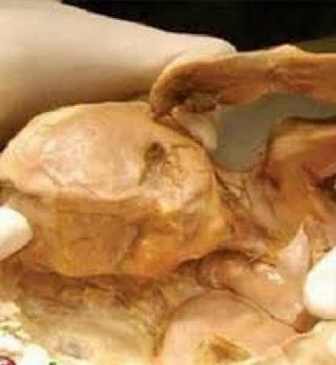 عجوز تلد طفلها بعد 40 عاما من الحمل.1