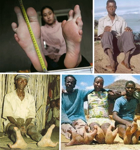 أغرب شعوب العالم ! قبيلة أقدام النعامة