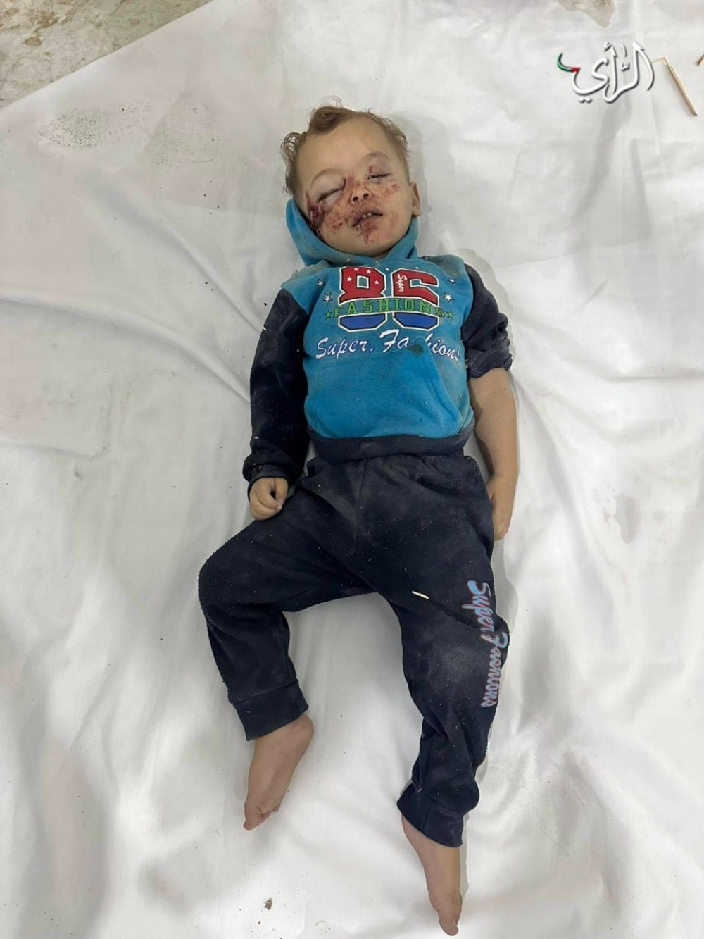 طفل شهيد جراء عدوان الاحتلال المستمر على قطاع غزة 