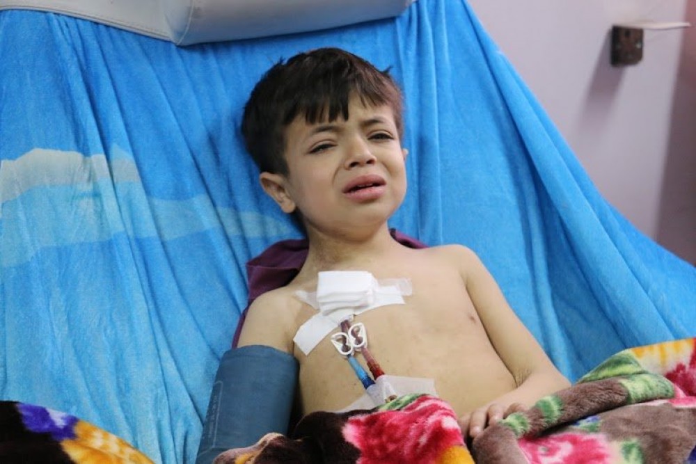 طفل  يعاني من فشل كلوي- صورة من الارشيف