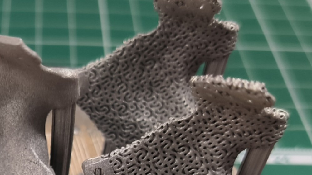 طباعة 3D تنتج غرسات عظمية مسامية تشبه العظام الحقيقية