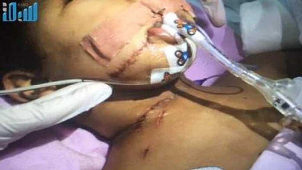 الطفل السعودي