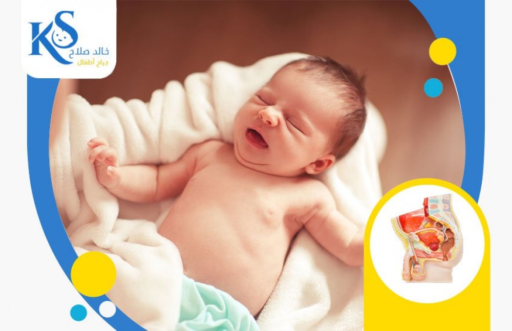 علامات وأعراض الفتق الإربي.. وأبرز المضاعفات