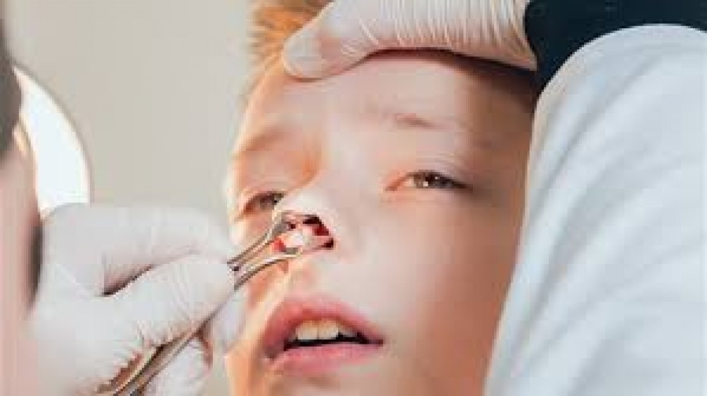 عدوى الجيوب الأنفية يمكن أن تسبب طنين الأذنين