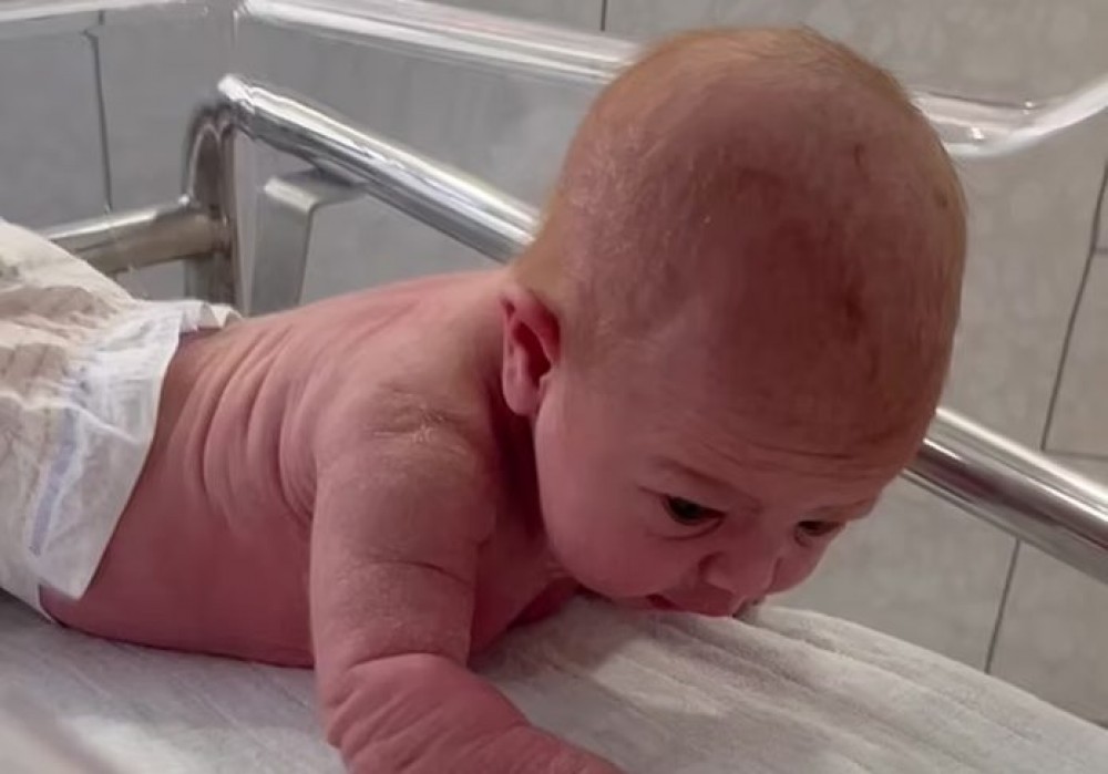 رضيعة ترفع رأسها وتحاول الزحف في عمر 3 أيام