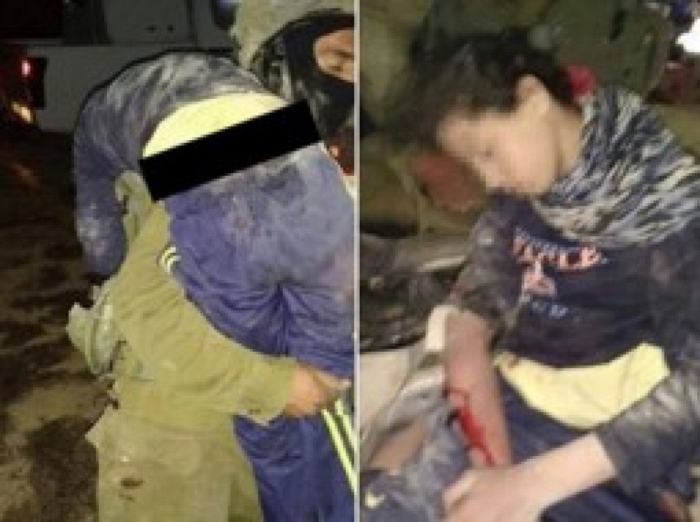 الطفلة الجريحة نور استبرق 