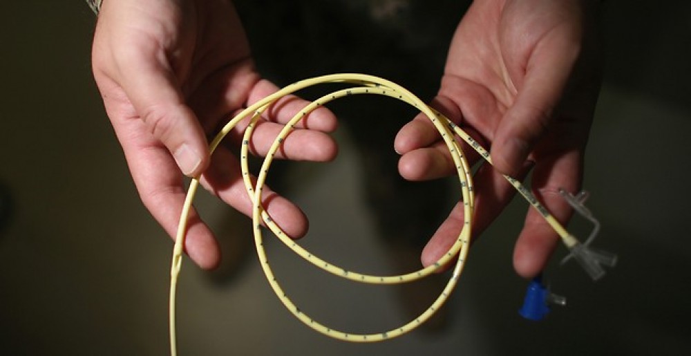 التغذية القسرية