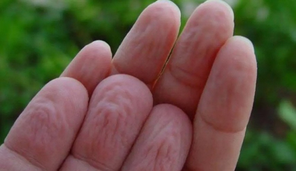 لمن يعاني من تقشر جلد الأصابع .. اليك هذه النصية الطبية!