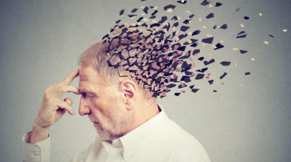العلماء يصممون جسماً مضاداً يساعد فى الكشف المبكر لمرض الزهايمر