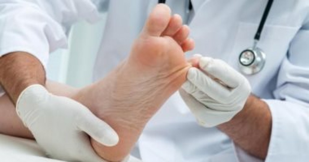8 نصائح صحية.. لتجنب الإصابة بالفطريات خلال فصل الصيف