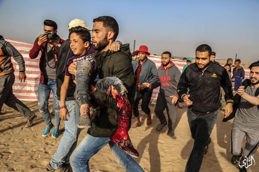 الطفل نوفل بعد إصابته برصاص الاحتلال 