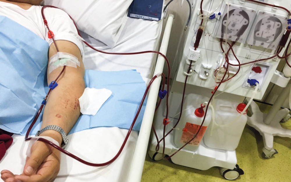 كل ما تريد معرفته عن أعراض غسيل الكلى