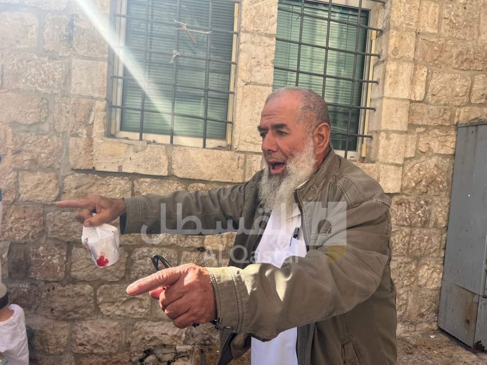 تعرضوا لاعتداء وحشي.. المرابطون على أبواب الأقصى: سنفديه بأرواحنا