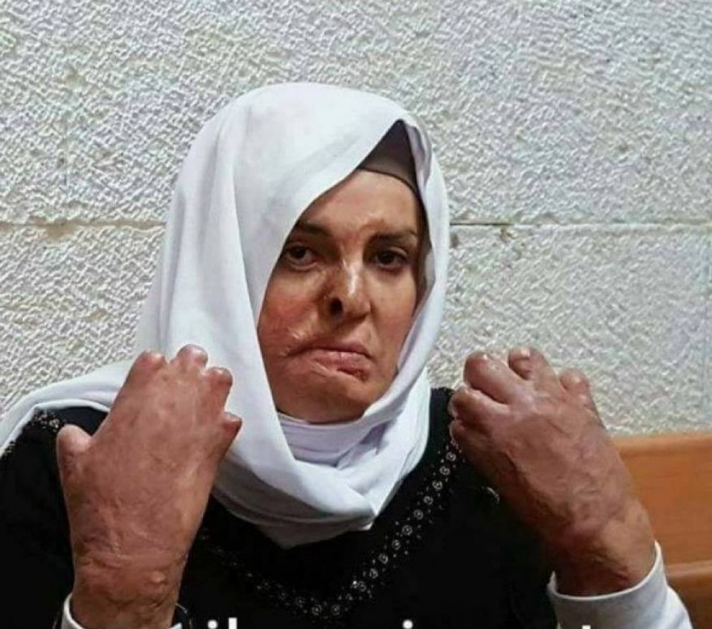 الأسيرة إسراء جعابيص 