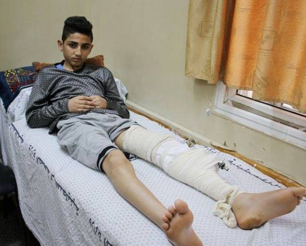 30429885_1520425541414079_178611197_n