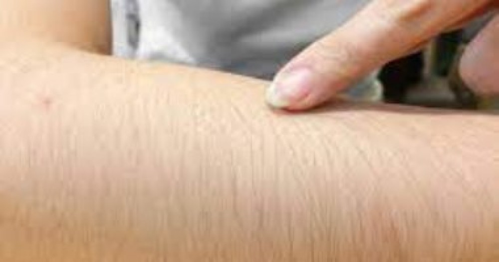 كثرة نمو الشعر بجسمك تعنى اضطرابات هرمونية أحيانا