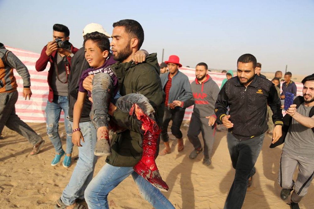 إصابة الطفل عبد الرحمن نوفل - تصوير عطية درويش