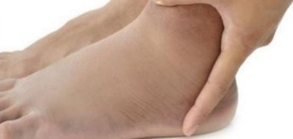 احتباس الماء.. الأسباب والأعراض وطرق العلاج