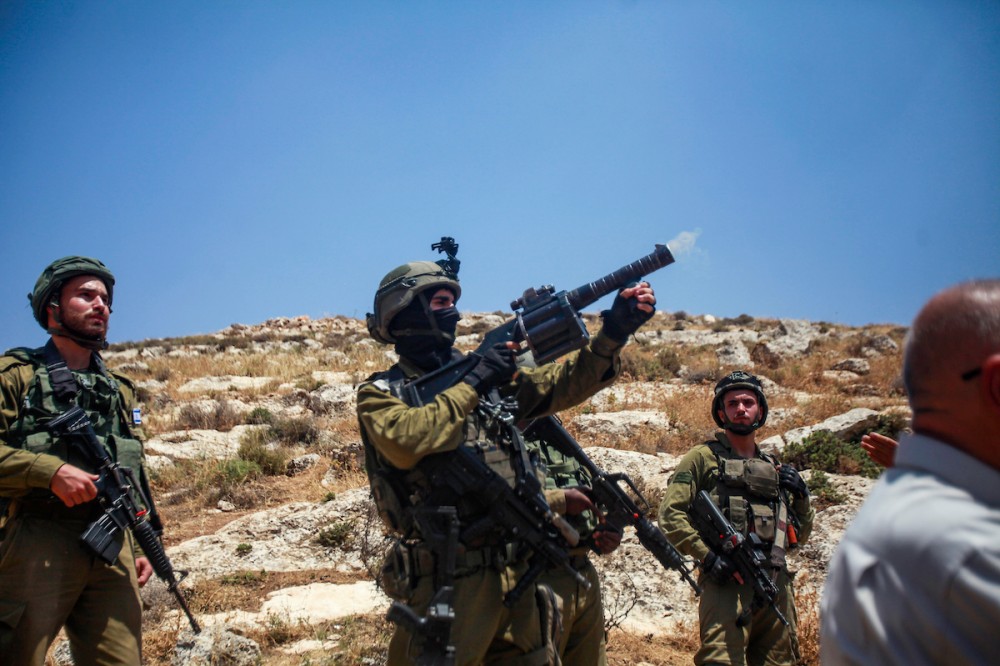 الاحتلال يصيب عدد من المواطنين في الضفة والقدس