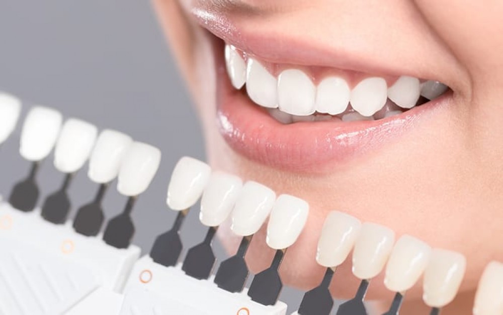 طبيب يوضح سبب تلف أسنان الحوامل