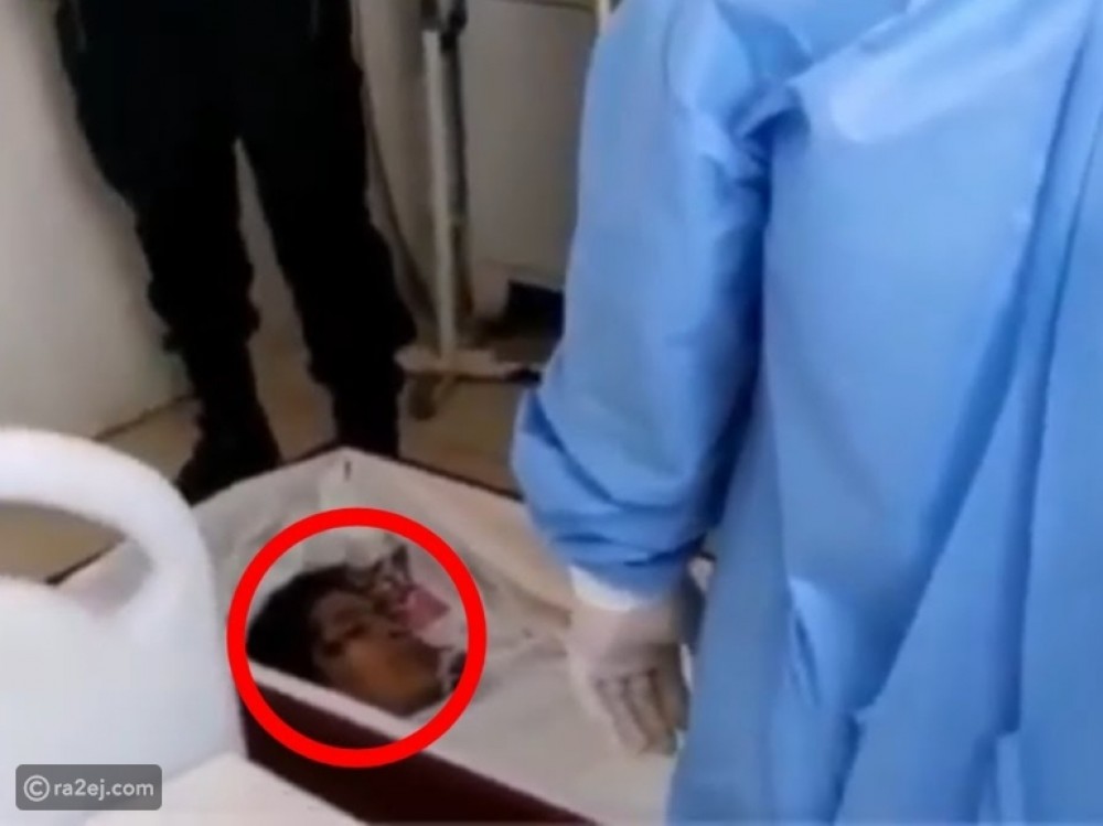 امرأة متوفية تعود للحياة قبل لحظات من دفنها