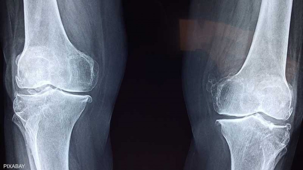 صحة العظام.. دراسة تفضل رياضة كرة القدم على الجري