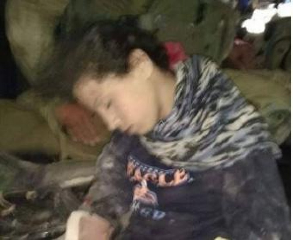 الطفلة المصابة بعد أن تم اعتقالها 
