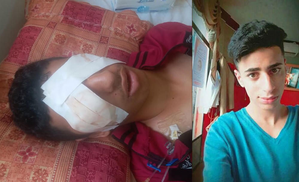 الفتى-صالح-عاشور-مهدد-بفقدان-البصر-إن-لم-يتم-علاجه-بشكل-فوري