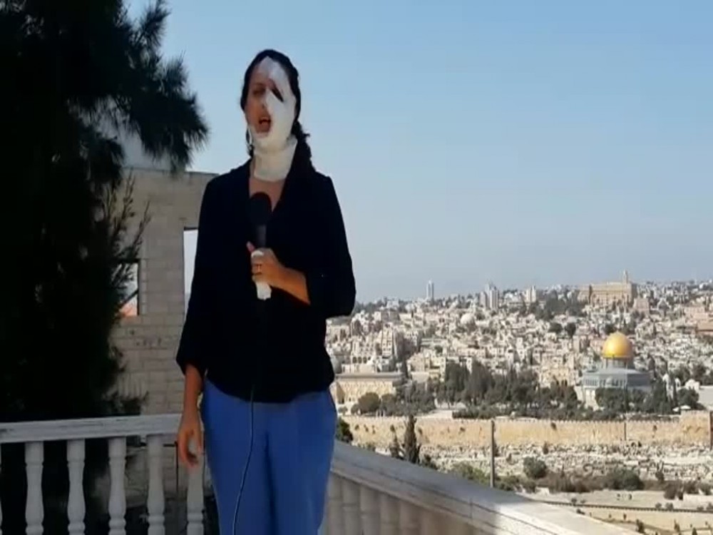 الصحفية هناء محاميد خلال تغطية صحفية بعد إصابتها أرشيف