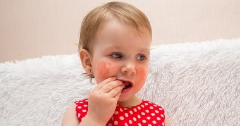 7 أطعمة قد تسبب الحساسية عند الأطفال.. منها الحليب البقرى
