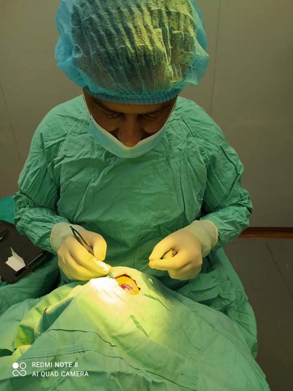 مستشفى العيون يجري عملية لرضيع جراء اصابته بسلك معدني