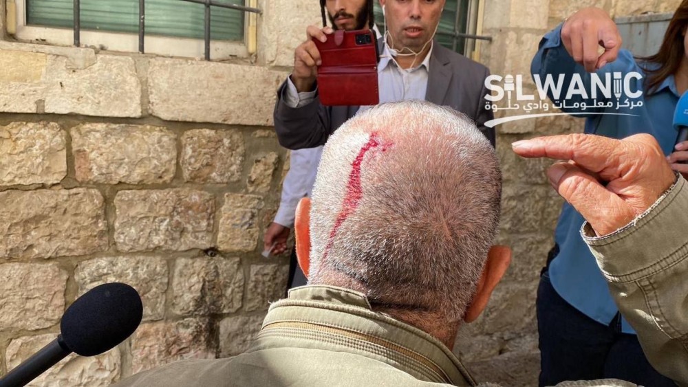 الاعتداء على المرابطين في الأقصىالاعتداء على المرابطين في الأقصى2