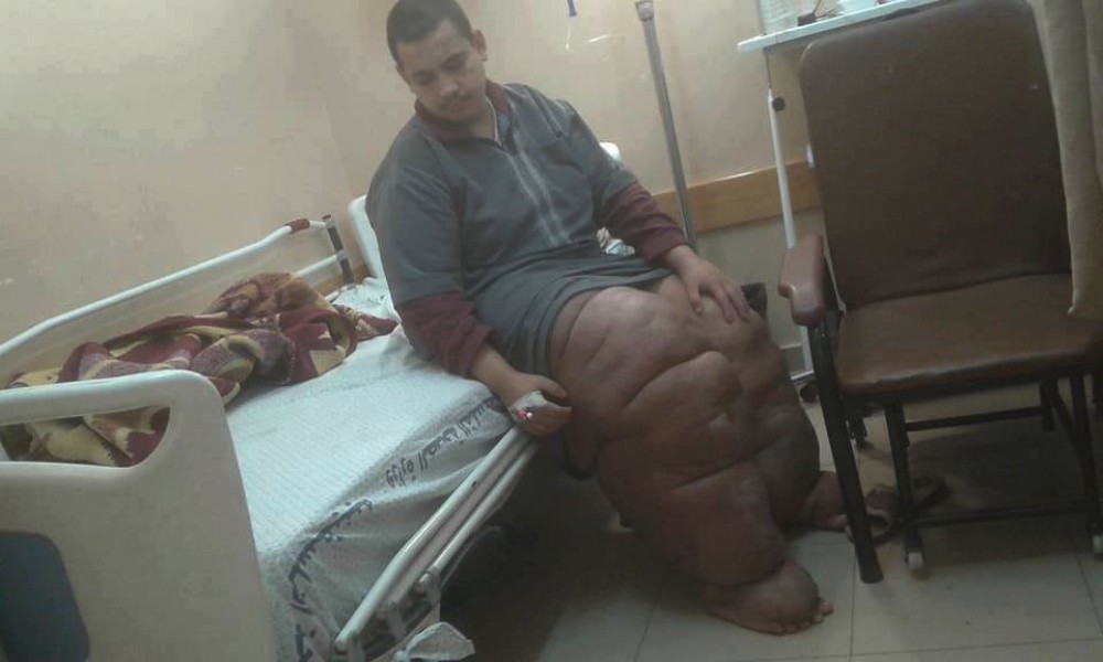 المريض صلاح البلبيسي ينتظر العلاج2