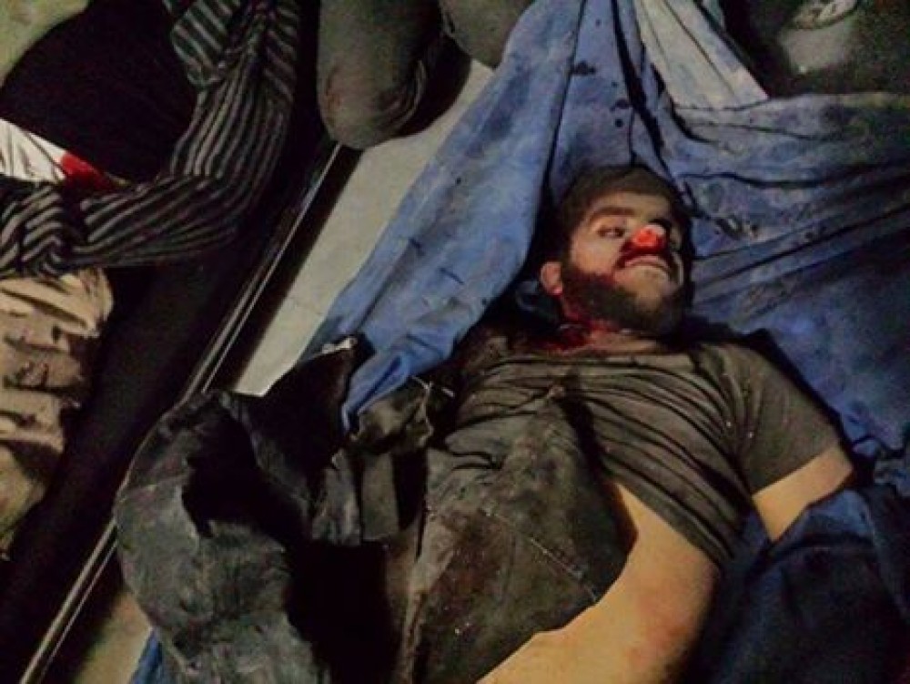 أحد الشهداء الذين سقطوا بقذائف الهاون باليرموك 