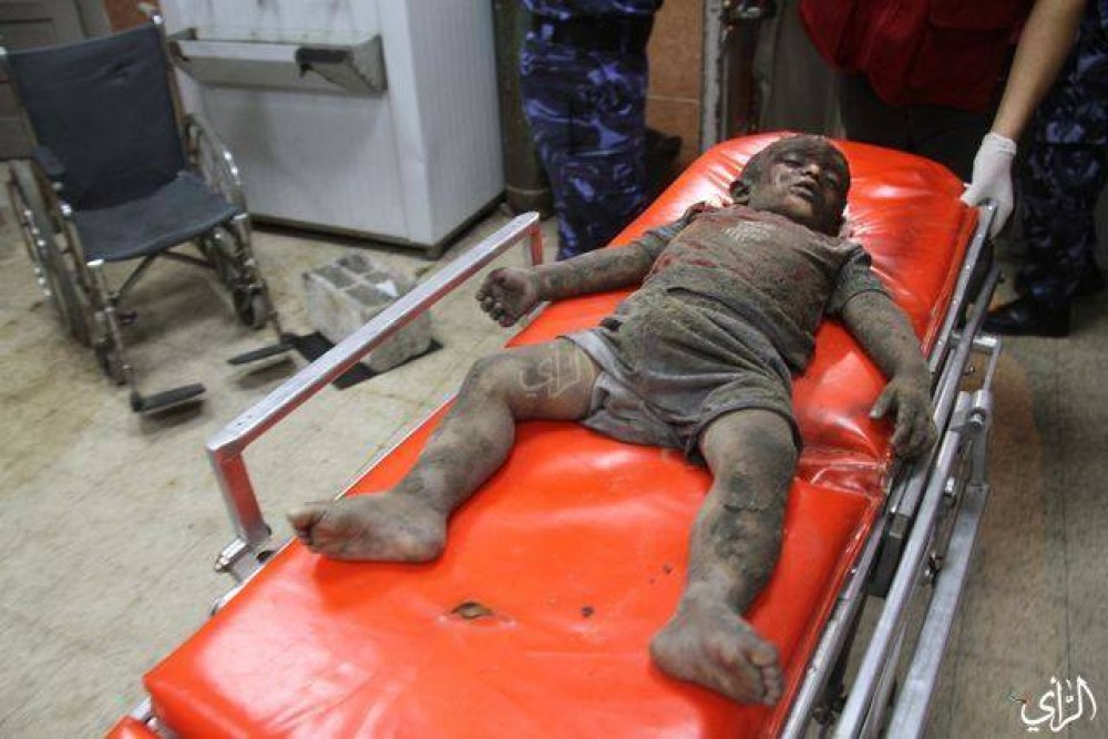 أحد شهدء عائلة النجار الأطفال 