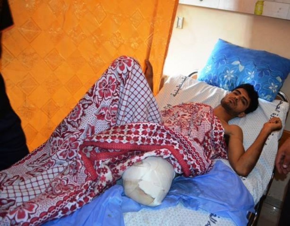 الجريح محمد أبو بيض