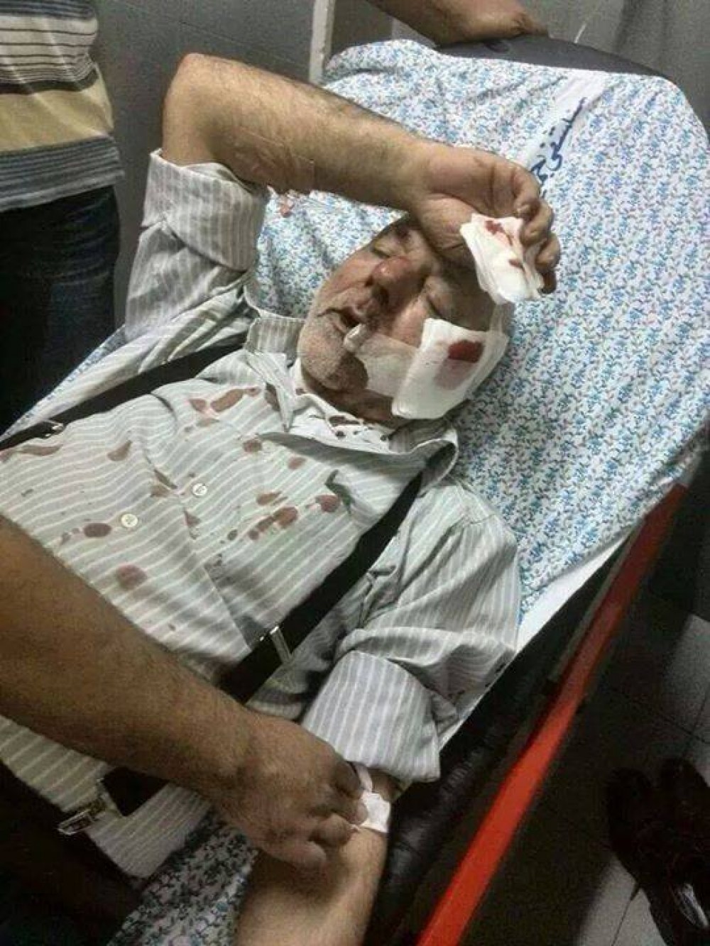 صورة للمسن عندما أصيب 